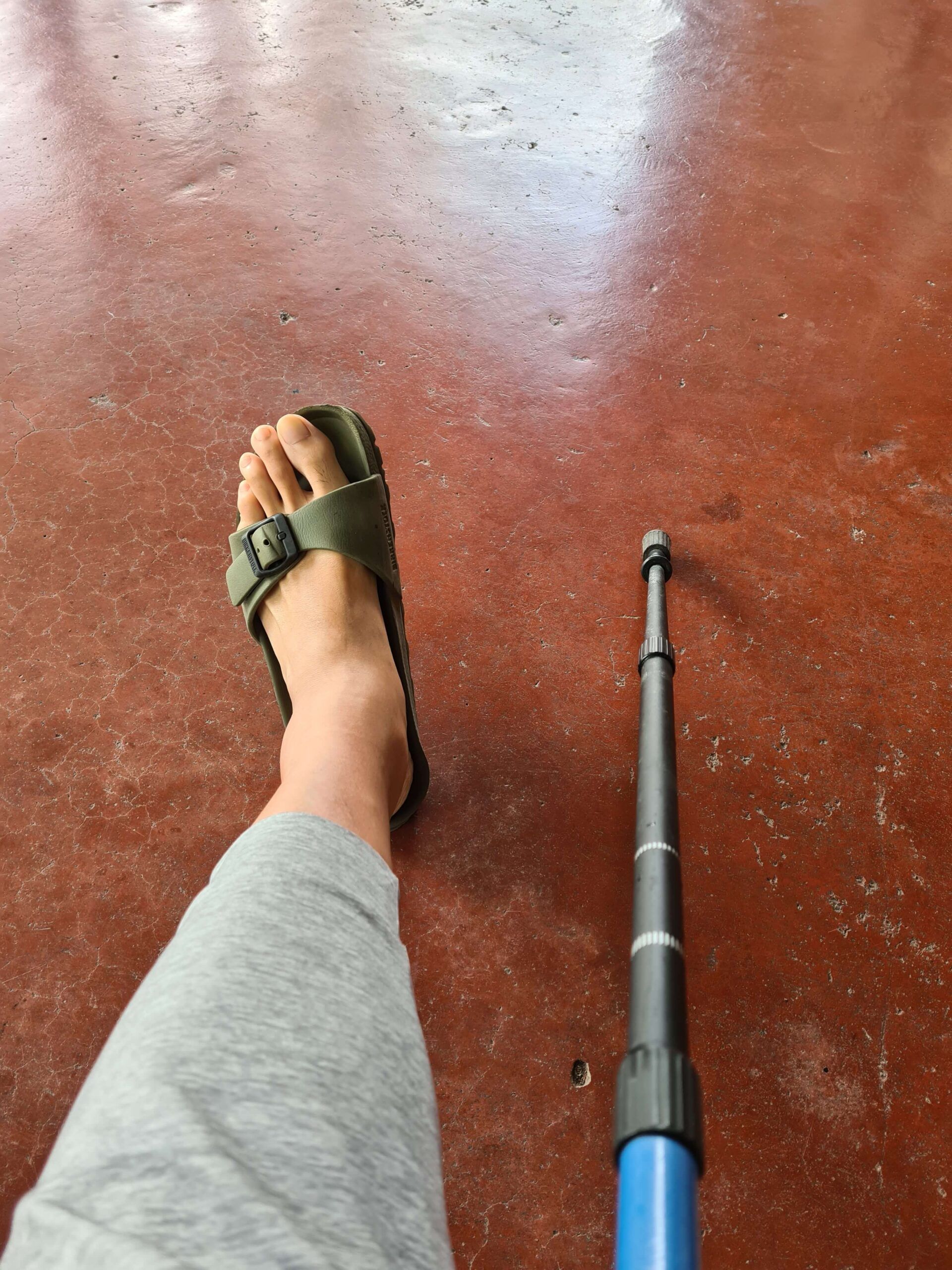 3.-swollen-ankle-with-walking-aid