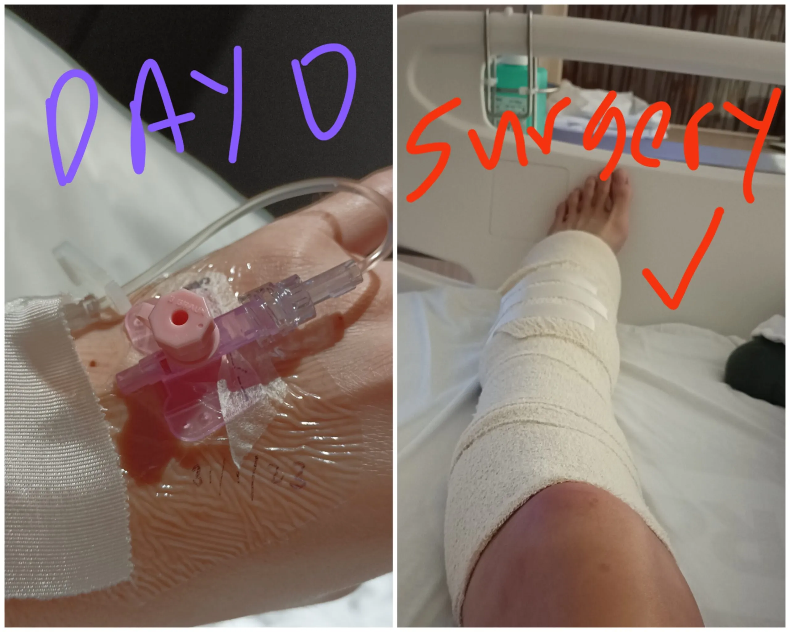 2. Day 0 - Day of Surgery_10-8